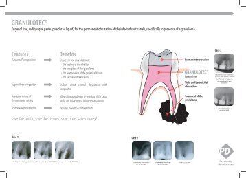 GRANULOTEC®