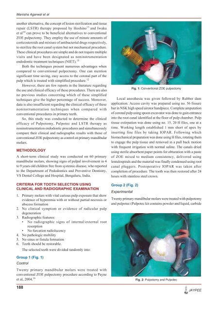 to View In Vivo Study - universaldental.com.pk