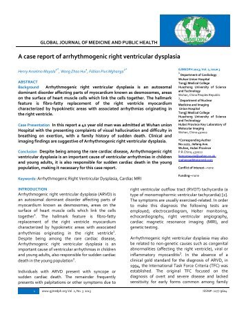 A case report of arrhythmogenic right ventricular dysplasia