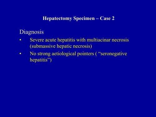 Acute Hepatitis Including Acute Liver Failure