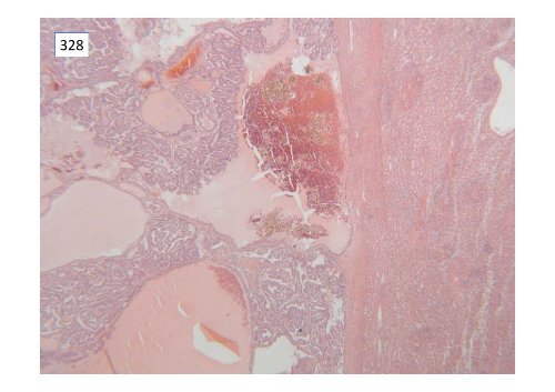 National Liver Histopathology EQA Scheme