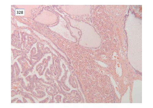 National Liver Histopathology EQA Scheme