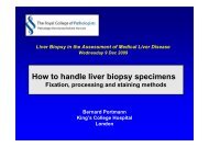 How to handle liver biopsy specimens