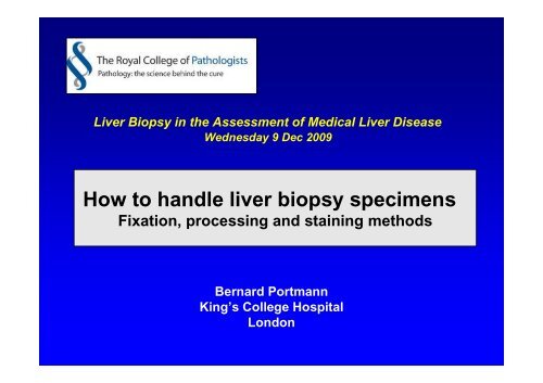 How to handle liver biopsy specimens