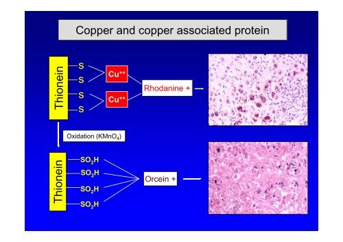 How to handle liver biopsy specimens