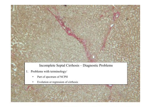 and Incomplete Septal Cirrhosis