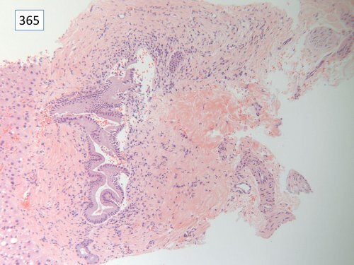 National Liver Histopathology EQA Scheme