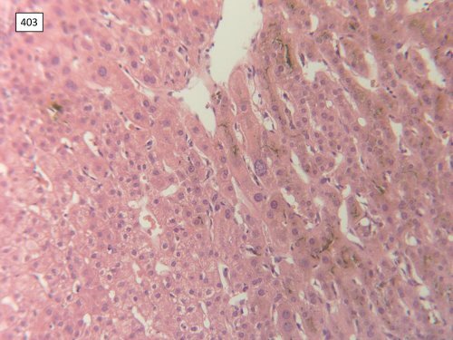 National Liver Histopathology EQA Scheme