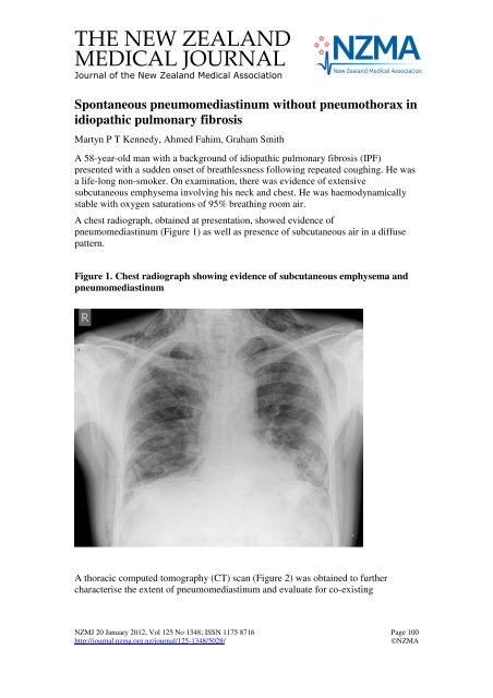 Spontaneous pneumomediastinum without pneumothorax in ...