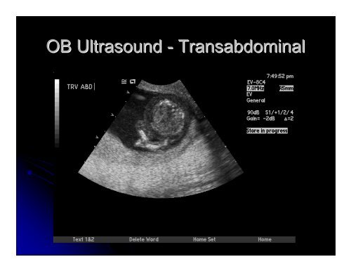 Case Presentation Vaginal Bleeding