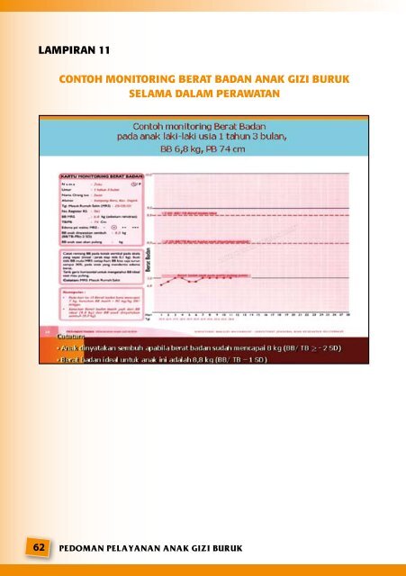 PEDOMAN PELAYANAN ANAK GIZI BURUK