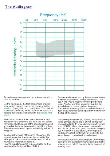 decibels Hearing Level Frequency (Hz)