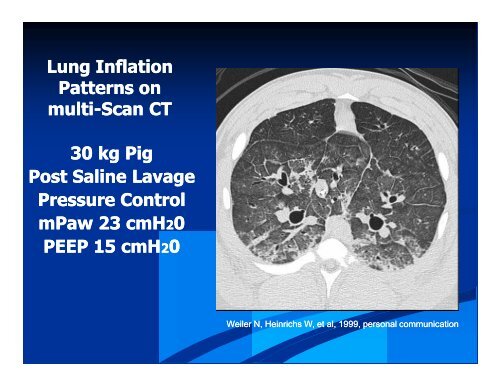 HFOV for Larger Pediatric and Adult Patients