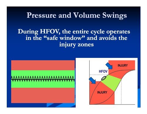 HFOV for Larger Pediatric and Adult Patients