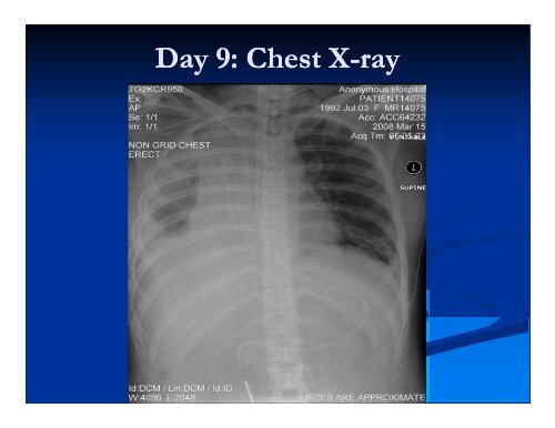 HFOV for Larger Pediatric and Adult Patients