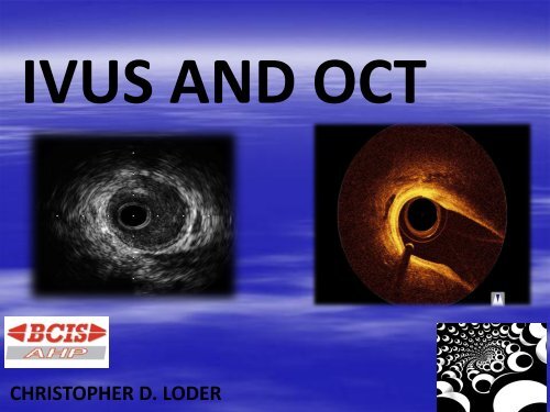 IVUS AND OCT