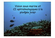 CI ophtalmologiques à la plongée loisir