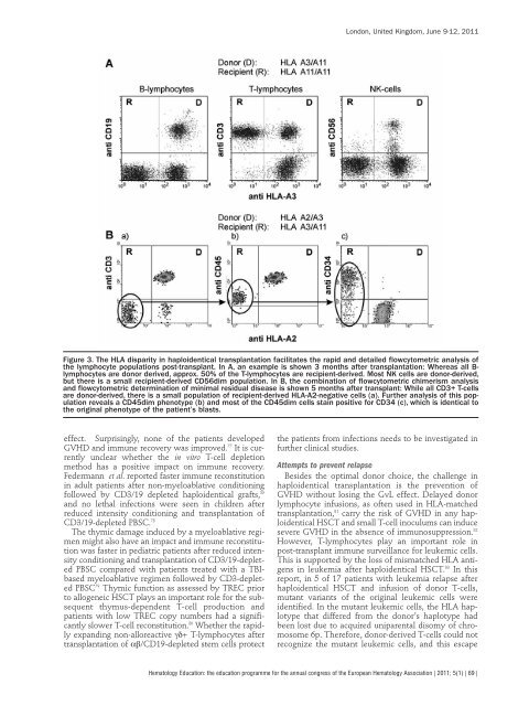 H e m a t o lo g y E d u c a t io n - European Hematology Association