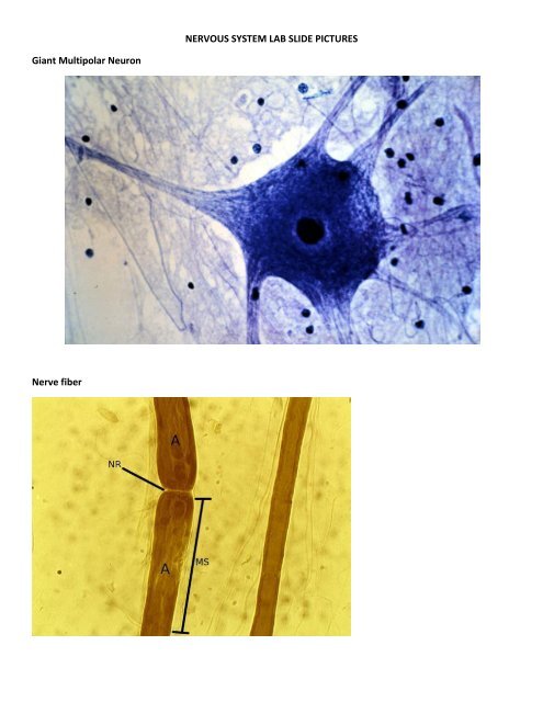 Multipolar Neuron Model Labeled