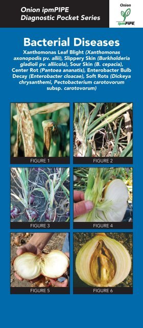 Bacterial Diseases