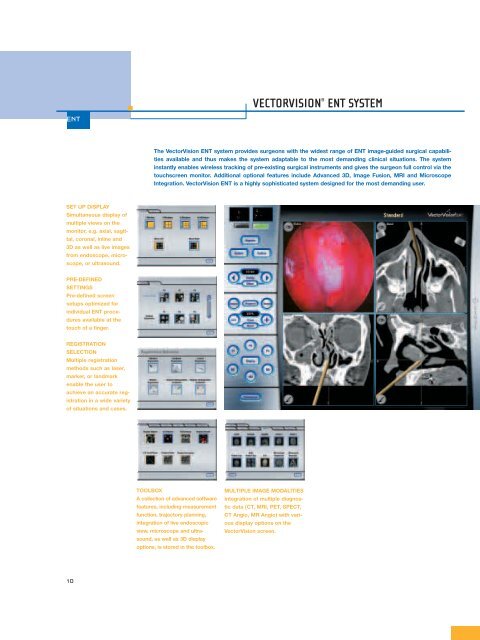 vectorvision® ent system