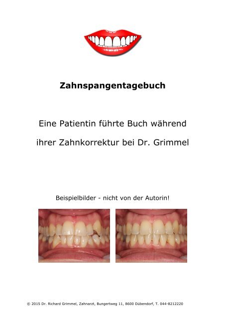 Zahnspangen-Tagebuch