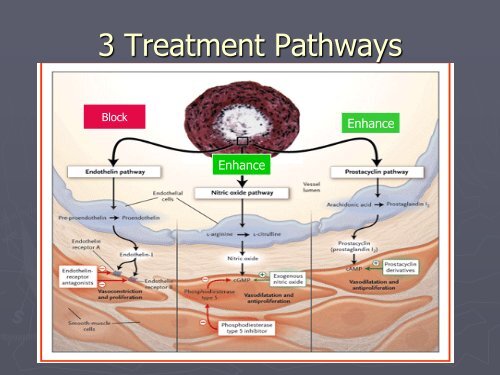 Pulmonary Hypertension