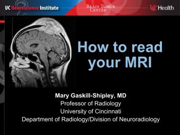 4_Gaskill_How+to+read+your+MRI
