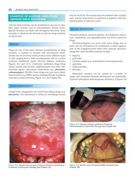 Clinical Pharmacology and Therapeutics