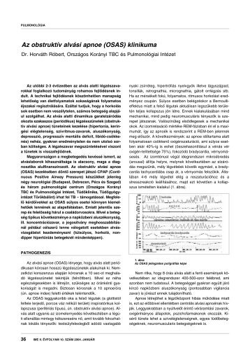 Az obstruktív alvási apnoe (OSAS) klinikuma - IME