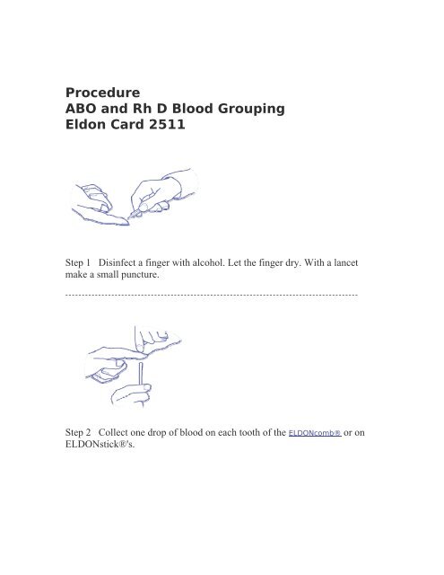 Procedure ABO and Rh D Blood Grouping Eldon Card 2511