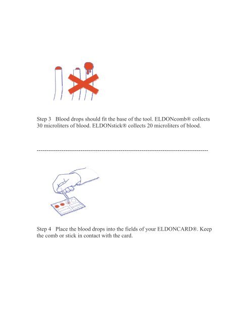 Procedure ABO and Rh D Blood Grouping Eldon Card 2511