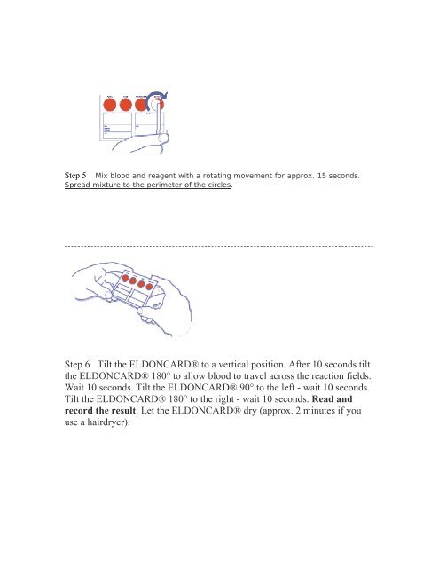 Procedure ABO and Rh D Blood Grouping Eldon Card 2511