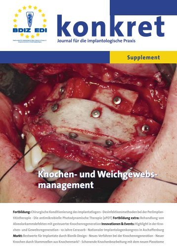 Knochen- und Weichgewebs- management Knochen- und - BdiZ