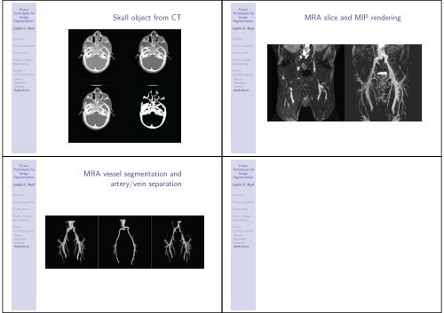 Fuzzy Techniques for Image Segmentation Outline ... - SSIP-2013