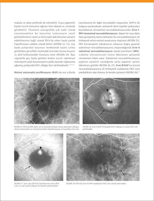 Bölüm 2 - Retina