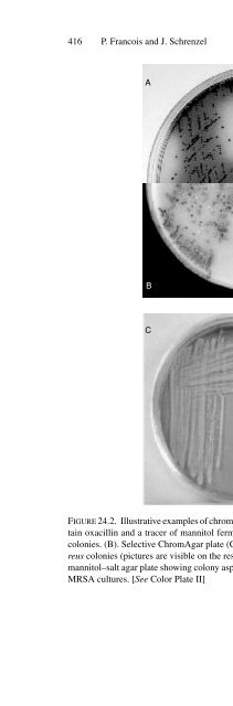 Advanced Techniques in Diagnostic Microbiology