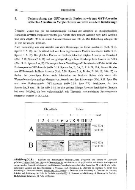 Arrestin hetero/oge Expression/l Mutagenese und biophy,sikalische Untersuchungen