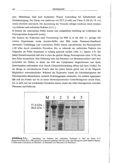 Arrestin hetero/oge Expression/l Mutagenese und biophy,sikalische Untersuchungen