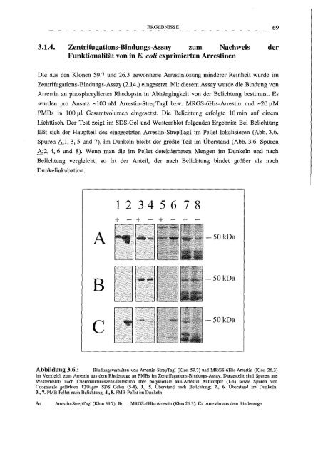 Arrestin hetero/oge Expression/l Mutagenese und biophy,sikalische Untersuchungen