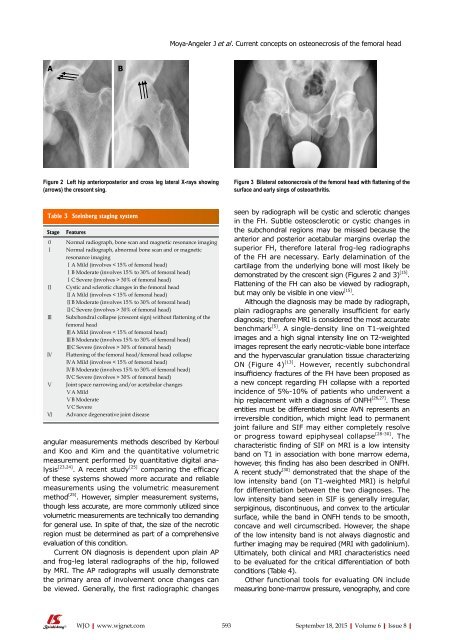 World Journal of Orthopedics