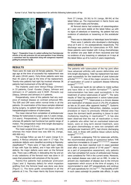 World Journal of Orthopedics