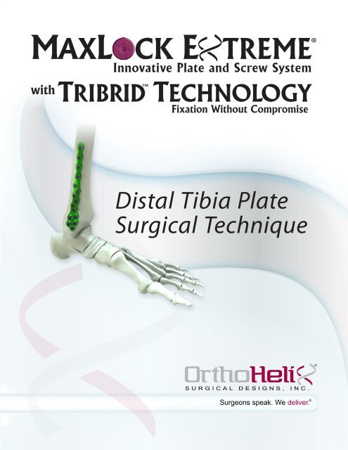 Distal Tibia Plate Surgical Technique