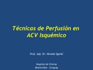 ACV Isquémico