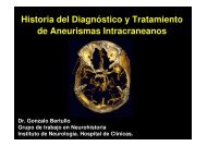 de Aneurismas Intracraneanos