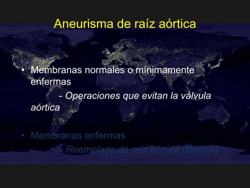 Raíz aórtica dilatada y aorta ascendente asintomáticas