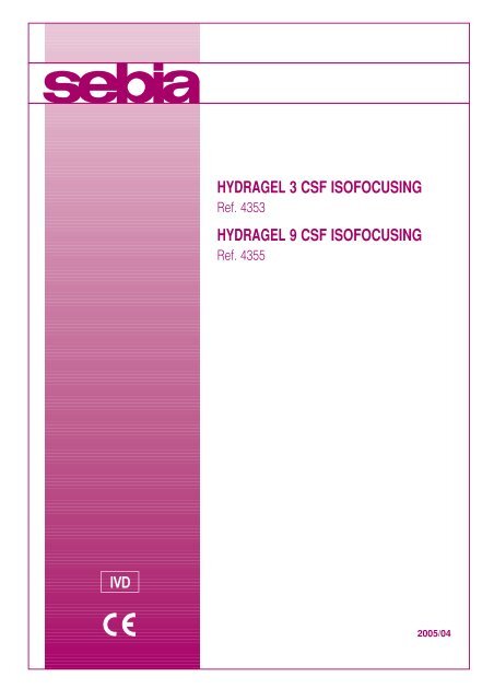 hydragel 3 csf isofocusing hydragel 9 csf isofocusing