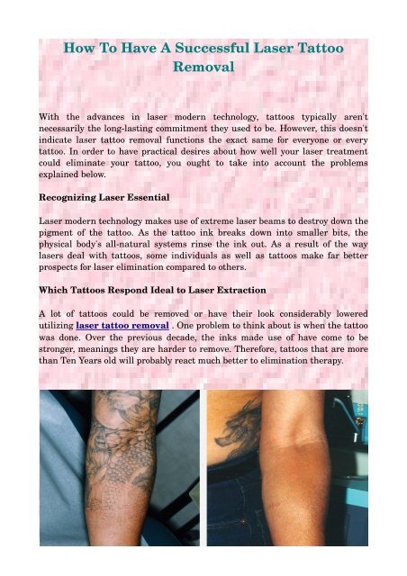 How To Have A Successful Laser Tattoo Removal