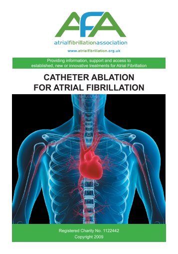 CATHETER ABLATION FOR ATRIAL FIBRILLATION