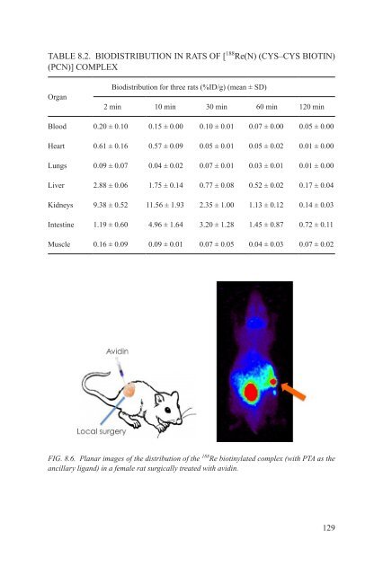 Yttrium-90 and Rhenium-188 Radiopharmaceuticals for Radionuclide Therapy